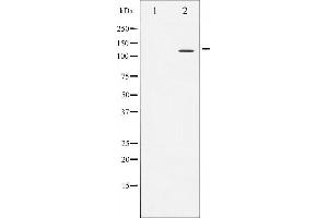 Western blot analysis of NFAT4 expression in HeLa whole cell lysates,The lane on the left is treated with the antigen-specific peptide.