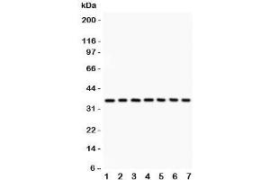 Western blot testing of IkBa antibody and Lane 1:  rat brain;  2: mouse brain;  3: (r) kidney;  4: (m) kidney;  5: human 293T;  6: (h) Jurkat;  7: (h) Raji lysate. (NFKBIA anticorps  (AA 3-112))