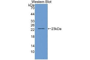 Western blot analysis of the recombinant protein. (D2HGDH anticorps  (AA 56-232))