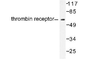 Image no. 1 for anti-Thyroid Hormone Receptor, alpha (THRA) antibody (ABIN271852) (THRA anticorps)
