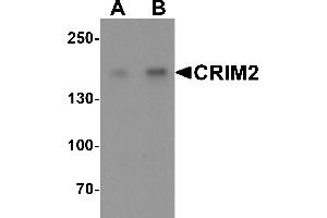 Western blot analysis of CRIM2 in Jurkat cell lysate with CRIM2 antibody at (A) 1 and (B) 2 µg/mL. (KCP anticorps  (C-Term))