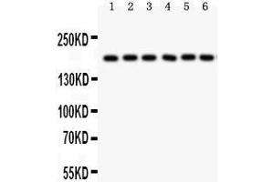 Western Blotting (WB) image for anti-Pregnancy-Associated Plasma Protein A, Pappalysin 1 (PAPPA) (AA 95-388) antibody (ABIN3043377) (PAPPA anticorps  (AA 95-388))