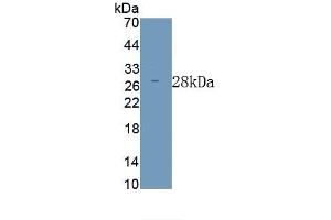 Detection of Recombinant ODC,Mouse using Polyclonal Antibody to Ornithine Decarboxylase (ODC) (ODC1 anticorps)
