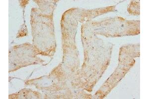 Immunohistochemistry of paraffin-embedded human skeletal muscle tissue using ABIN7149014 at dilution of 1:100 (CSRP3 anticorps  (AA 1-194))