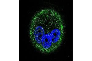 Confocal immunofluorescent analysis of PK15 Antibody (ABIN659038 and ABIN2838052) with MCF-7 cell followed by Alexa Fluor® 488-conjugated goat anti-mouse lgG (green). (MAPK15 anticorps)