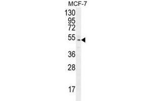 ZNF829 Antibody (Center) western blot analysis in MCF-7 cell line lysates (35 µg/lane). (ZNF829 anticorps  (Middle Region))