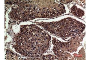 Immunohistochemistry (IHC) analysis of paraffin-embedded Human Lung, antibody was diluted at 1:100.