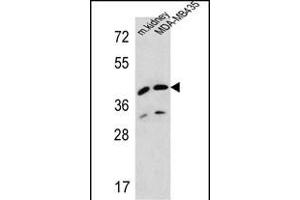 L2HGDH Antibody (Center) (ABIN654213 and ABIN2844053) western blot analysis in MDA-M cell line and mouse kidney tissue lysates (35 μg/lane). (L2HGDH anticorps  (AA 132-159))