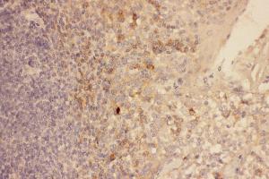 Anti-CXCR3 Picoband antibody,  IHC(P): Human Tonsil Tissue (CXCR3 anticorps  (AA 1-368))