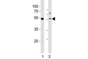 Western blot analysis of lysate from 1) human MCF-7 cell line and 2) mouse liver tissue tissue using Gata6 antibody at 1:1000. (GATA6 anticorps  (C-Term))