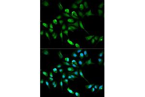 Immunofluorescence analysis of HepG2 cell using ADH5 antibody. (ADH5 anticorps  (AA 1-374))