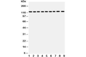 Western blot testing of TRPC3 antibody and Lane 1:  rat liver (TRPC3 anticorps  (AA 836-851))