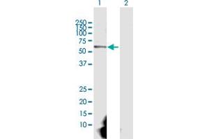 Western Blot analysis of CAMK2G expression in transfected 293T cell line by CAMK2G MaxPab polyclonal antibody. (CAMKII gamma anticorps  (AA 1-527))
