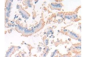 Detection of CD10 in Rat Small intestine Tissue using Polyclonal Antibody to Neprilysin (CD10)