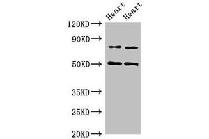 Western Blot Positive WB detected in: Rat heart tissue, Mouse heart tissue All lanes: Acss2 antibody at 4 μg/mL Secondary Goat polyclonal to rabbit IgG at 1/50000 dilution Predicted band size: 79 kDa Observed band size: 79, 50 kDa (ACSS2 anticorps  (AA 1-701))