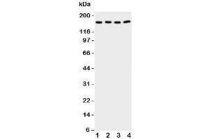 Western blot testing of CPLA2 antibody and Lane 1:  rat testis;  2: (r) brain;  3: human A549;  4: (h) COLO320 cell lysate.