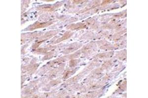 Immunohistochemistry of TRPC3 in mouse heart tissue with this product at 10 μg/ml. (TRPC3 anticorps  (N-Term))