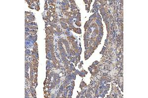 IHC analysis of SLC20A1 using anti-SLC20A1 antibody (ABIN7602463).
