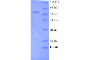 Oncostatin M (OSM) (AA 26-220), (full length) protein (GST tag)