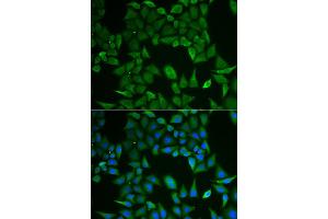 Immunofluorescence analysis of HeLa cell using CLPS antibody. (CLPS anticorps)