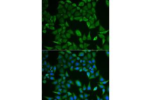 Immunofluorescence analysis of HeLa cell using CLPS antibody. (CLPS anticorps)