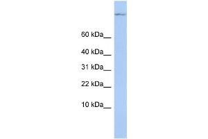 Western Blotting (WB) image for anti-TSC22 Domain Family, Member 1 (TSC22D1) antibody (ABIN2458107) (TSC22D1 anticorps)
