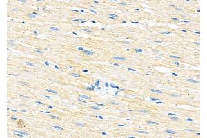ABIN6260179 and ABIN6279190 at 1/100 staining Rat heart tissue by IHC-P. (B4GALT7 anticorps)