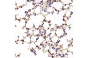 Immunohistochemistry of paraffin-embedded Mouse lung using TSC22D3 antibody at dilution of 1:100 (x400 lens). (TSC22D3 anticorps)