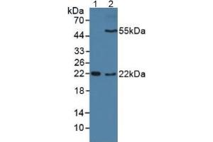 Western blot analysis of (1) Mouse Sp2/0 Cells and (2) Mouse Placenta Tissue. (DC-SIGN/CD209 anticorps  (AA 70-404))