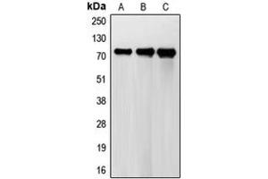 Western blot analysis of FSHR expression in HeLa (A), A431 (B), H1299 (C) whole cell lysates. (FSHR anticorps  (Center))