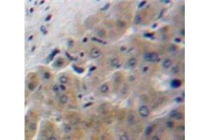 IHC-P analysis of Liver tissue, with DAB staining. (Apolipoprotein F anticorps  (AA 122-307))