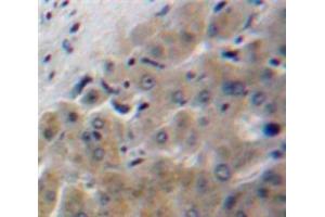 IHC-P analysis of Liver tissue, with DAB staining. (Apolipoprotein F anticorps  (AA 122-307))