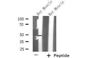 Western blot analysis of extracts from Rat muscle, using KCNK12 antibody. (KCNK12 anticorps  (N-Term))