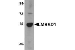 Western Blotting (WB) image for anti-LMBR1 Domain Containing 1 (LMBRD1) (C-Term) antibody (ABIN1030488)
