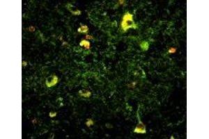 Immunofluorescence analysis of Rab5 antibody with paraffin-embedded human brain tissue.