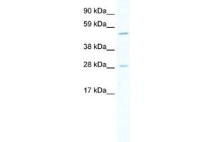 WB Suggested Anti-ASCL2 Antibody Titration:  5. (ASCL2 anticorps  (Middle Region))