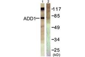 Western blot analysis of extracts from HeLa cells, treated with Forskolin 40nM 30', using ADD1 (Ab-726) Antibody. (alpha Adducin anticorps  (AA 688-737))