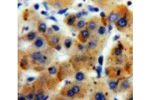 IHC-P analysis of Liver tissue, with DAB staining. (ADAMTS7 anticorps  (AA 1589-1686))