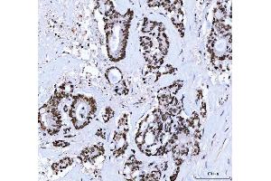 IHC analysis of CTBP2 using anti-CTBP2 antibody (ABIN7601326). (CTBP2 anticorps  (AA 321-445))