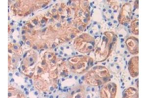 Detection of IL17RE in Mouse Kidney Tissue using Polyclonal Antibody to Interleukin 17 Receptor E (IL17RE) (IL17RE anticorps  (AA 457-630))