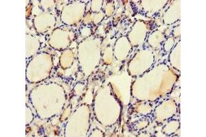 Immunohistochemistry of paraffin-embedded human thyroid tissue using ABIN7174476 at dilution of 1:100 (UBE2Q2 anticorps  (AA 1-375))