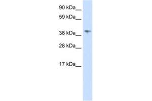 Western Blotting (WB) image for anti-Male-Specific Lethal 3 Homolog (MSL3) antibody (ABIN2461970) (MSL3 anticorps)