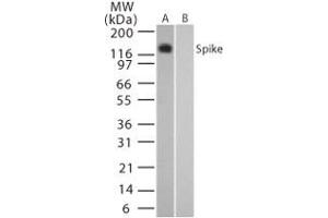 Image no. 2 for anti-SARS-Coronavirus Spike Protein (SARS-CoV S) (AA 1124-1140) antibody (ABIN199984) (SARS-CoV Spike anticorps  (AA 1124-1140))