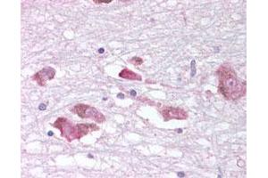 Immunohistochemical (Formalin/PFA-fixed paraffin-embedded sections) staining of human substantia nigra in brain. (MCHR1 anticorps)