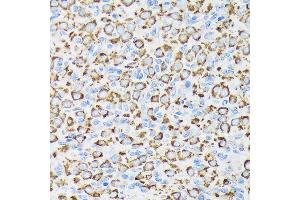 Immunohistochemistry of paraffin-embedded rat ovary using NDUFS4 Rabbit mAb (ABIN7268821) at dilution of 1:100 (40x lens).
