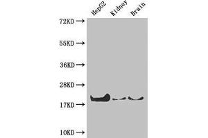 Western Blot Positive WB detected in: HepG2 whole cell lysate, Mouse kidney tissue, Mouse brain tissue All lanes: PPIA antibody at 4 μg/mL Secondary Goat polyclonal to rabbit IgG at 1/50000 dilution Predicted band size: 19, 12 kDa Observed band size: 19 kDa (PPIA anticorps  (AA 1-165))