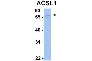 Human 721_B cells ACSL1 is strongly supported by BioGPS gene expression data to be expressed in Human 721_B cells