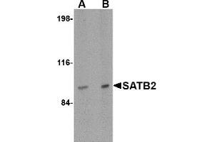 Western Blotting (WB) image for anti-SATB Homeobox 2 (SATB2) (N-Term) antibody (ABIN1031555) (SATB2 anticorps  (N-Term))