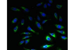 Immunofluorescent analysis of Hela cells using ABIN7152238 at dilution of 1:100 and Alexa Fluor 488-congugated AffiniPure Goat Anti-Rabbit IgG(H+L)