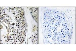 Immunohistochemistry analysis of paraffin-embedded human testis tissue, using CEP170 Antibody. (CEP170 anticorps  (AA 701-750))